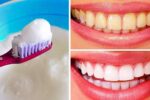 آیا سفیدکردن دندان با راهکارهای خانگی کار درستی است؟